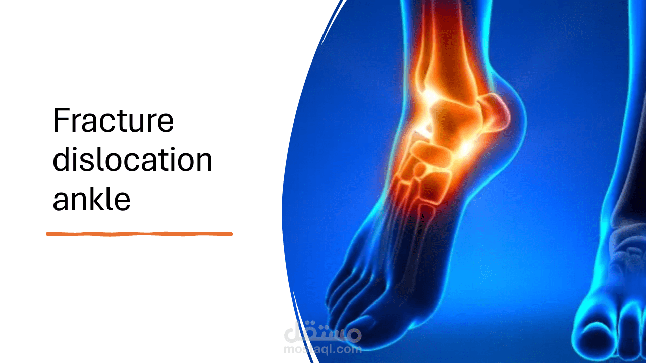 كسر في مفصل الكاحل - fracture dislocation ankle