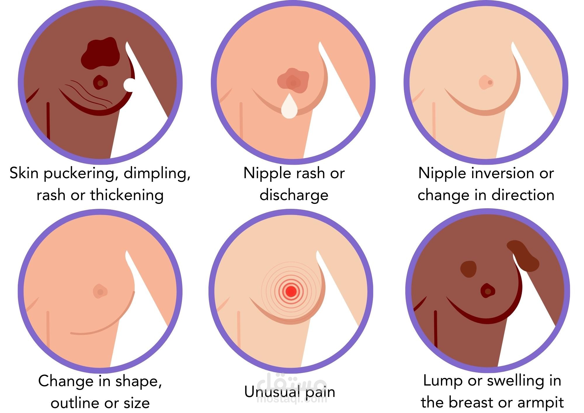 Breast Cancer Classification