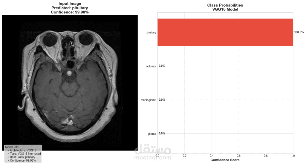 Brain Tumor Classification using Deep Learning