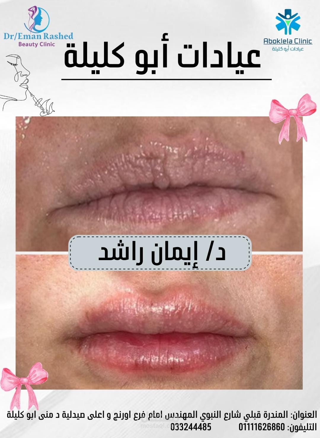تجميل