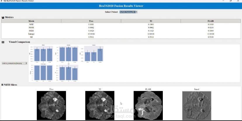 Multimodal MRI Brain Tumor Image Fusion Pipeline | AI & Bioinformatics