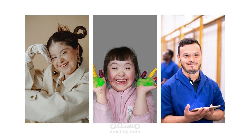 مقال عن متلازمة الداون