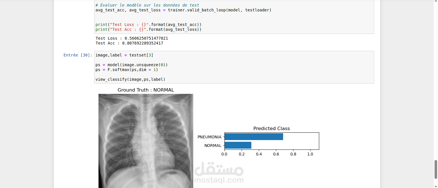 تصنيف التهاب الرئة (Pneumonia) في صور أشعة الصدر باستخدام PyTorch وEfficientNet