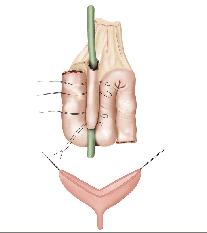 Medical drawing