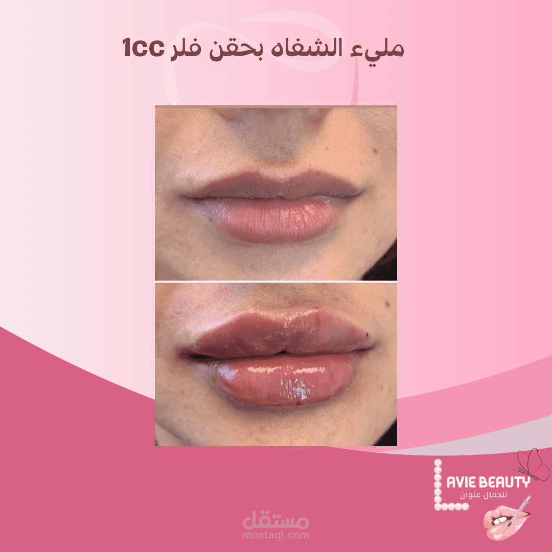 في العيادة التجميليه لاداره الصفحة وتصميم البوسترات