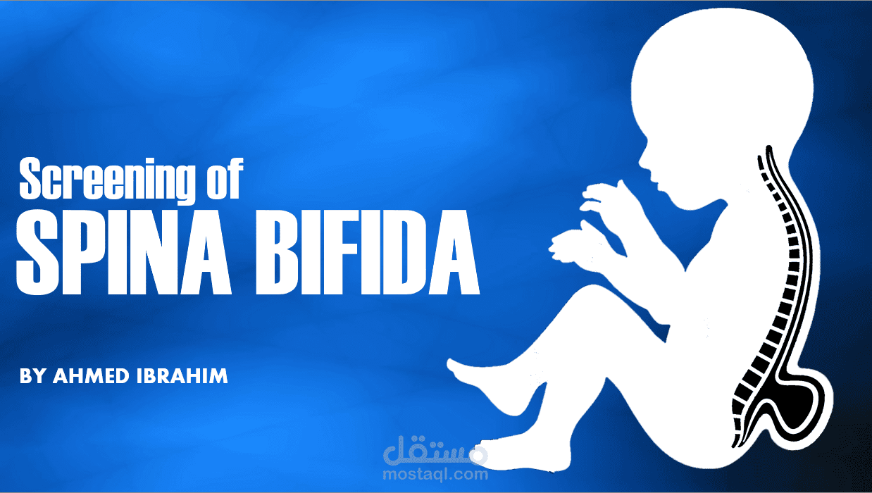 عرض PowerPoint طبي احترافي عن Screening of Spina Bifida