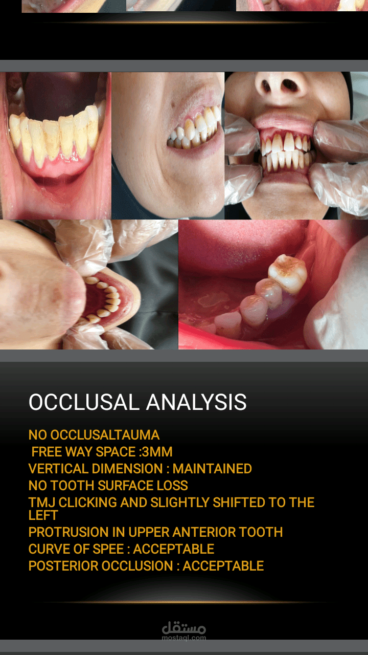 case presentation