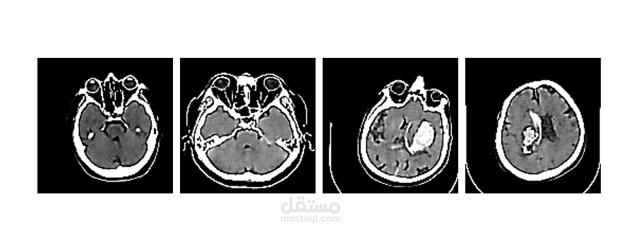 Brain Stroke CT Image Generation