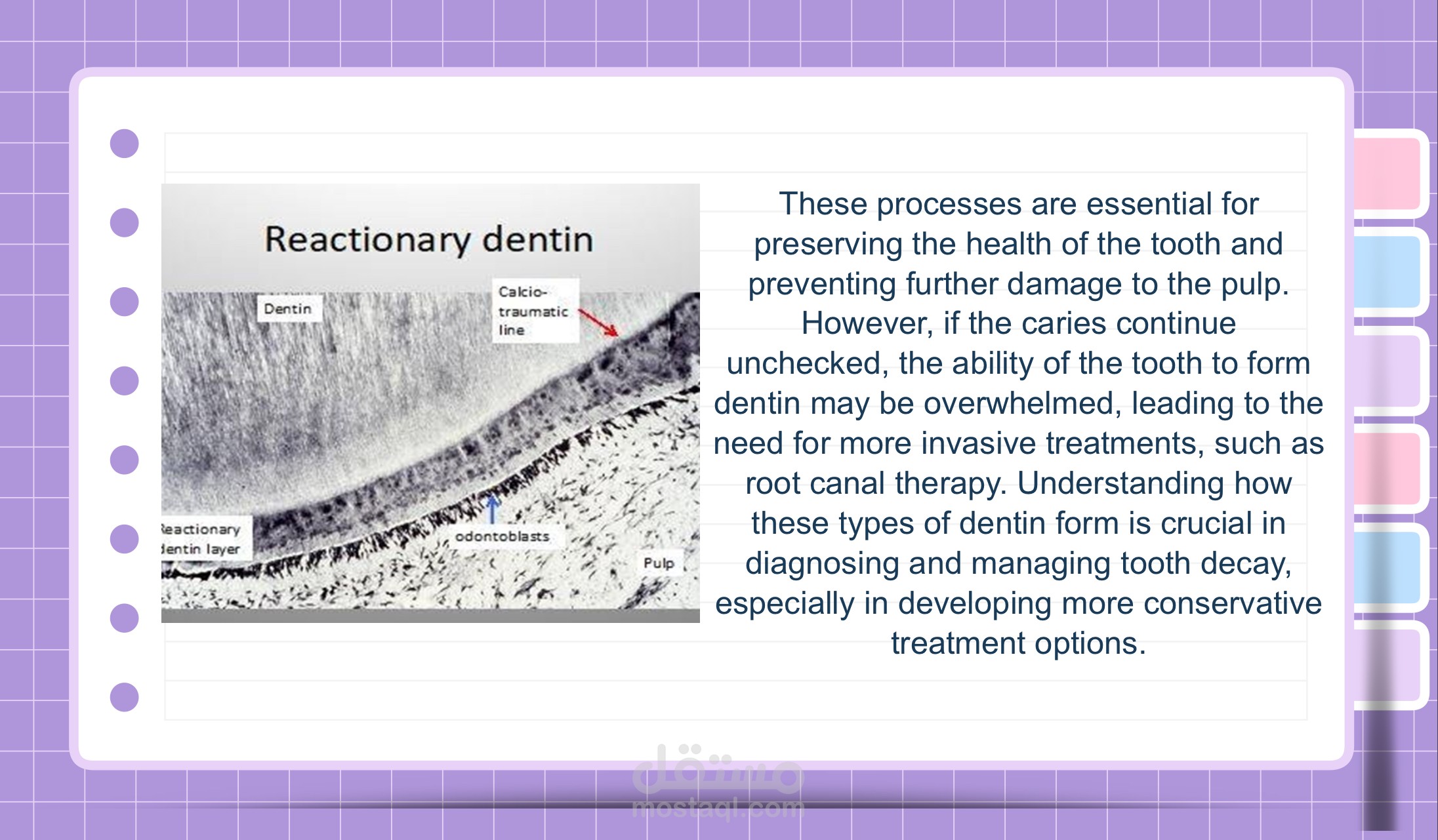 Reparative and reactionary dentin in response to caries