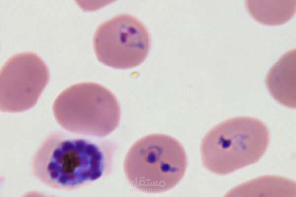Malaria Cell LeNet Diagnosis