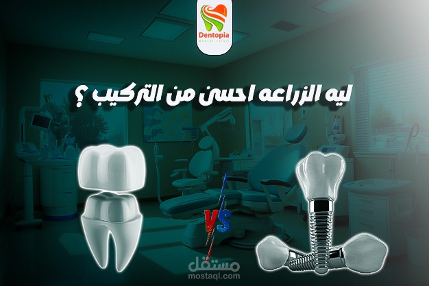 اهميه زراعه الاسنان