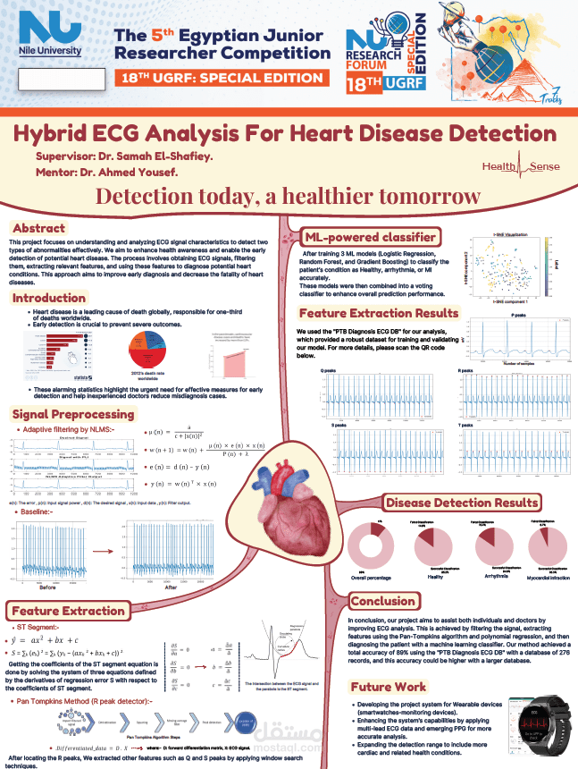 ECG signal analysis