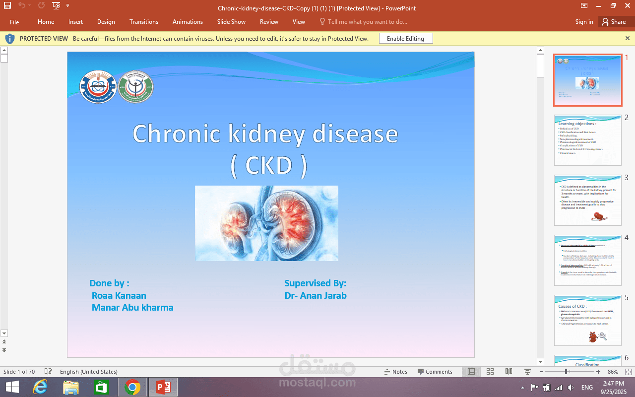 عرض power point عن مرض الكلى المزمن