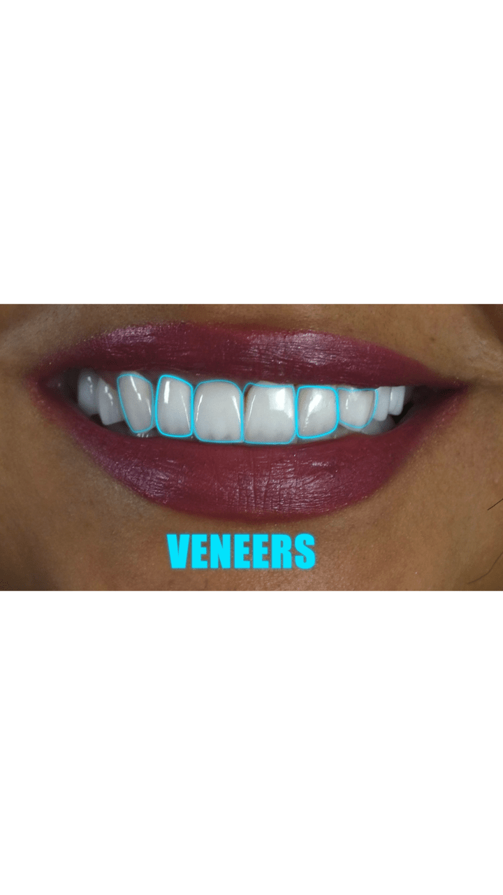 Dental Motion Graphic | Animation that Makes You Smile #dentistry #dentist #dental_motion_graphic