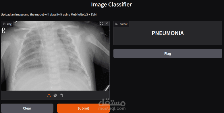 موذج ذكي للكشف عن الالتهاب الرئوي من صور الأشعة باستخدام OpenCV وتعلم الآلة