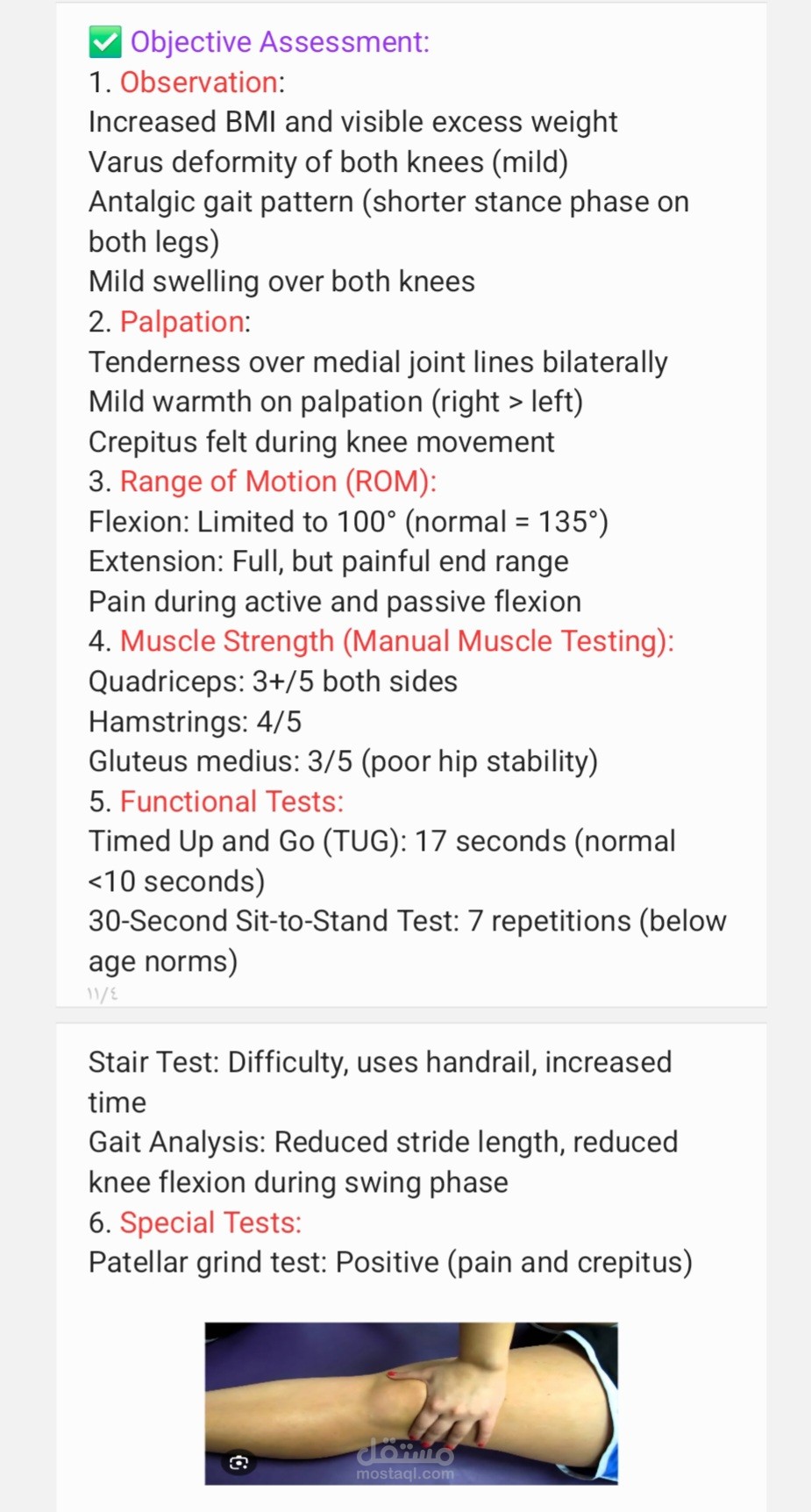 Translated Medical Case Report-OA following ACL injury  )