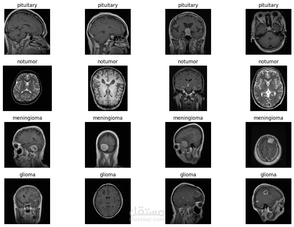 Brain Tumor MRI Classification using CNN Model