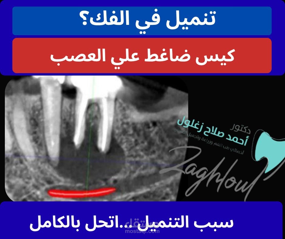 عمل صوره افتتاحيه لفديو حاله لمريض خاص بدكتور اسنان