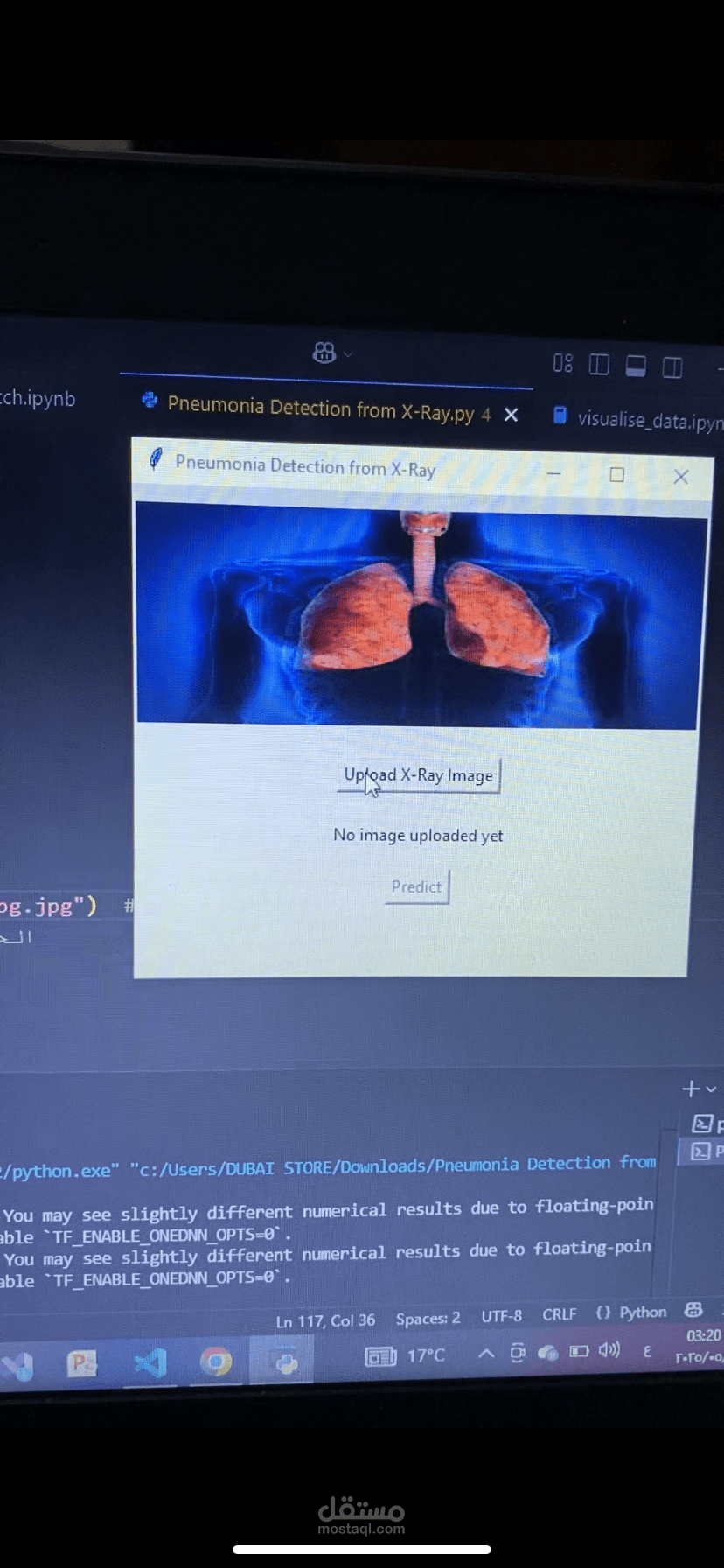 Chest X-ray Classification