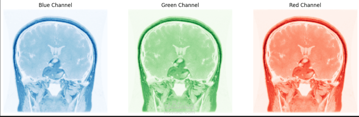 brain tumor detector