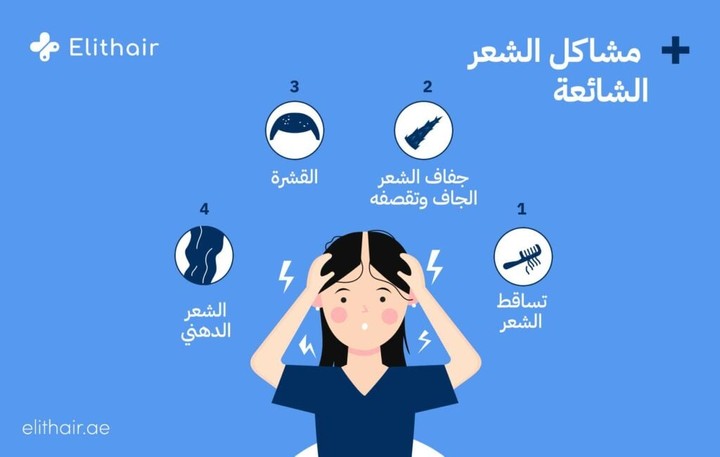 اسكربت فيديو طبي عن مشاكل الشعر