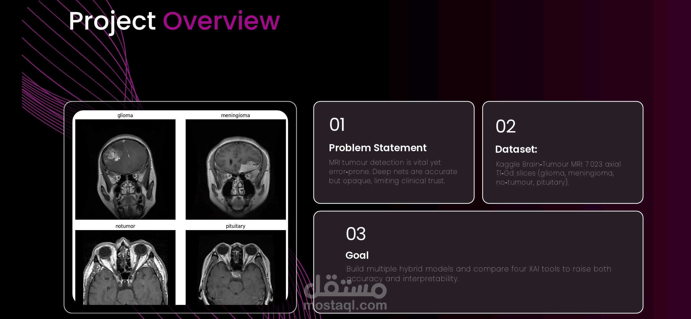 Explainable AI for Brain Tumor Detection