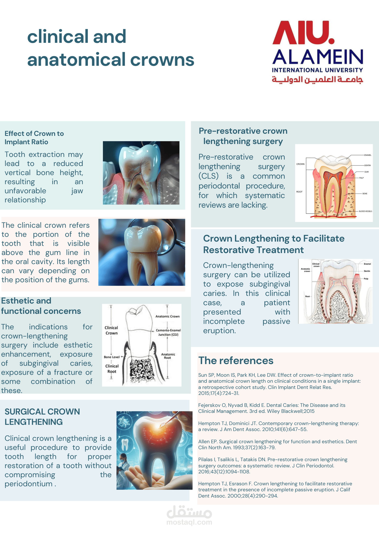 Anatomical and clinical crown