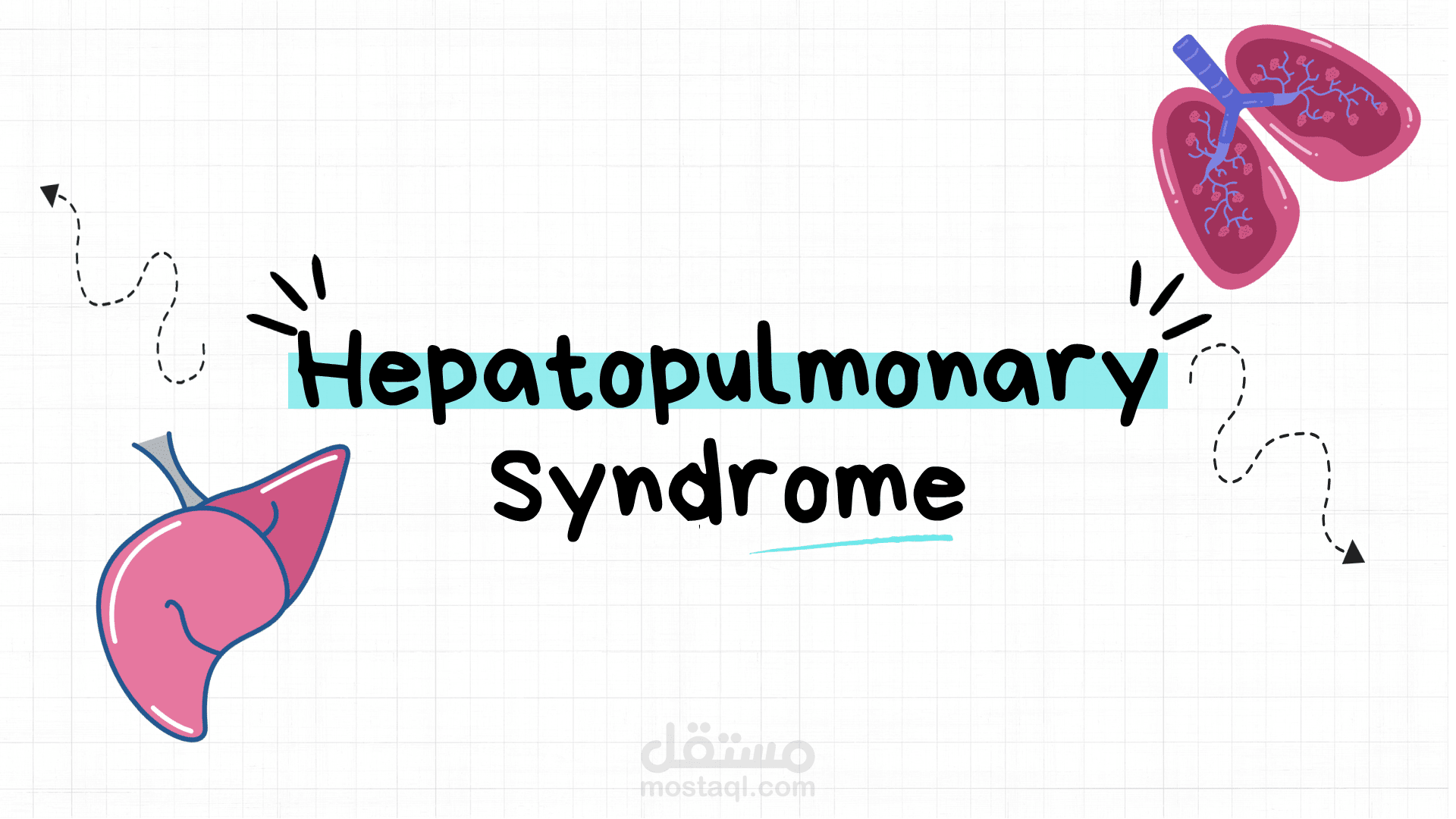 عرض تقديمي عن Hepatopulmonary syndrome