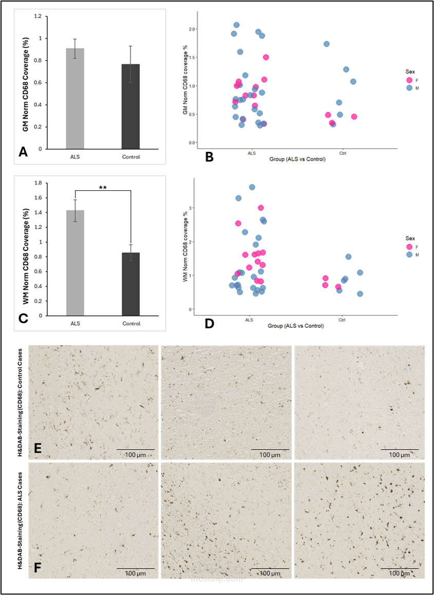 Comparison of CD68 Coverage in Grey and White Matter Between ALS and Control Groups Stratified by Sex