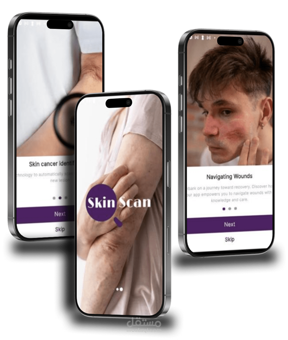 skin Scan Tech
