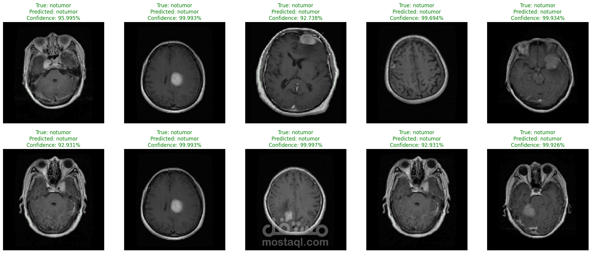 Brain Tumor Classification (MRI) 3 Models 98%