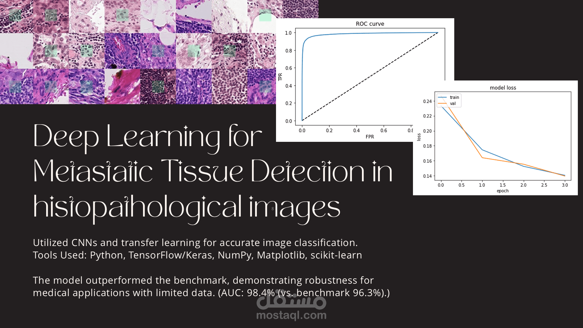 Deep Learning for Metastatic Tissue Detection in histopathological images