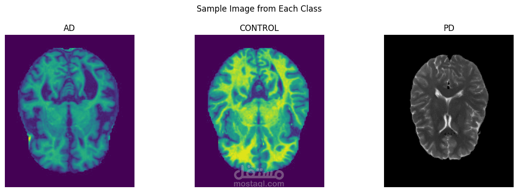 Alzheimer-Classification