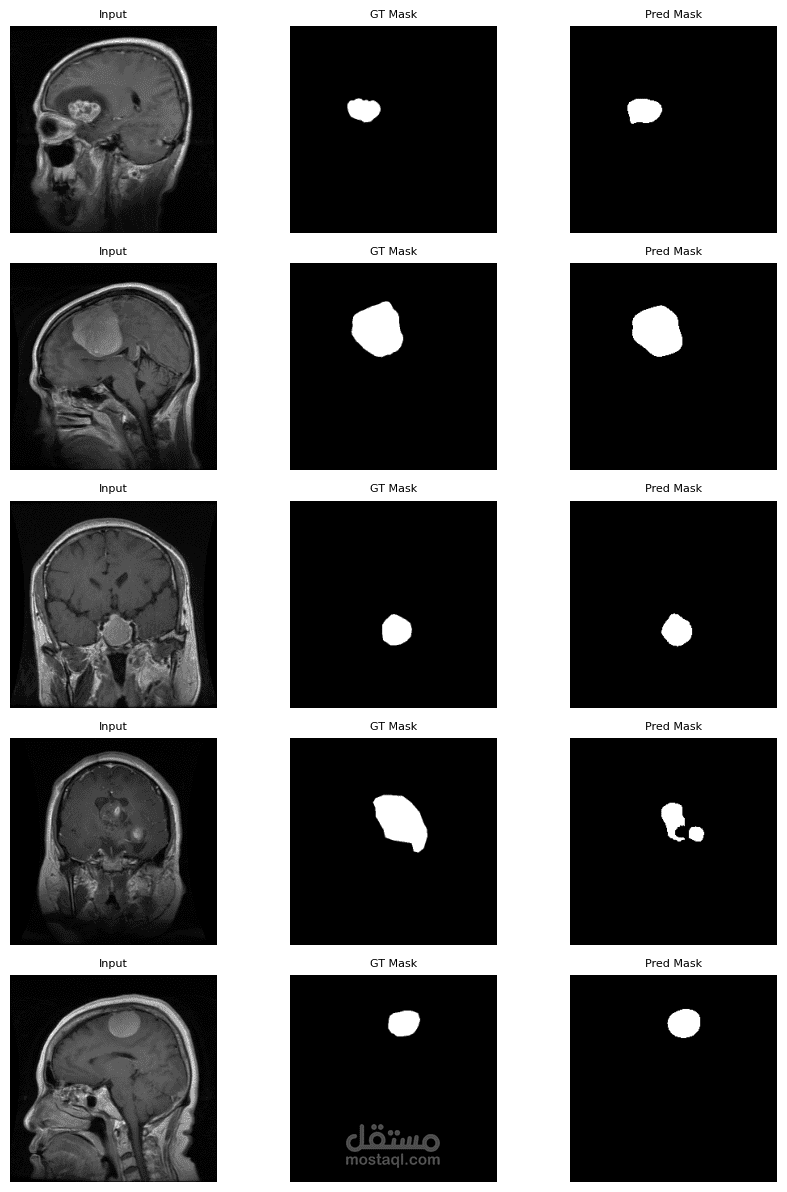 segmentation