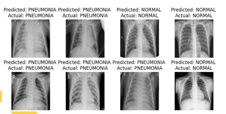 Chest X-ray Pneumonia Classification with CNN