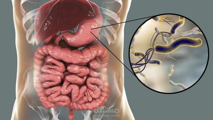 أهم 5 وصفات طبيعية للتخلص من جرثومة المعدة