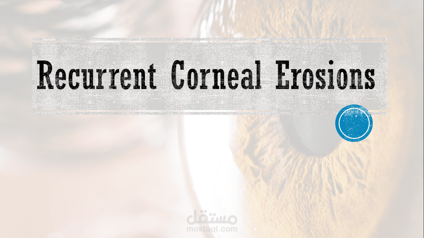 عرض تقديمي عن "Recurrent Corneal Erosions"