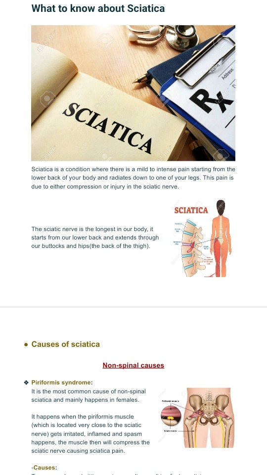 Medical article about Sciatica