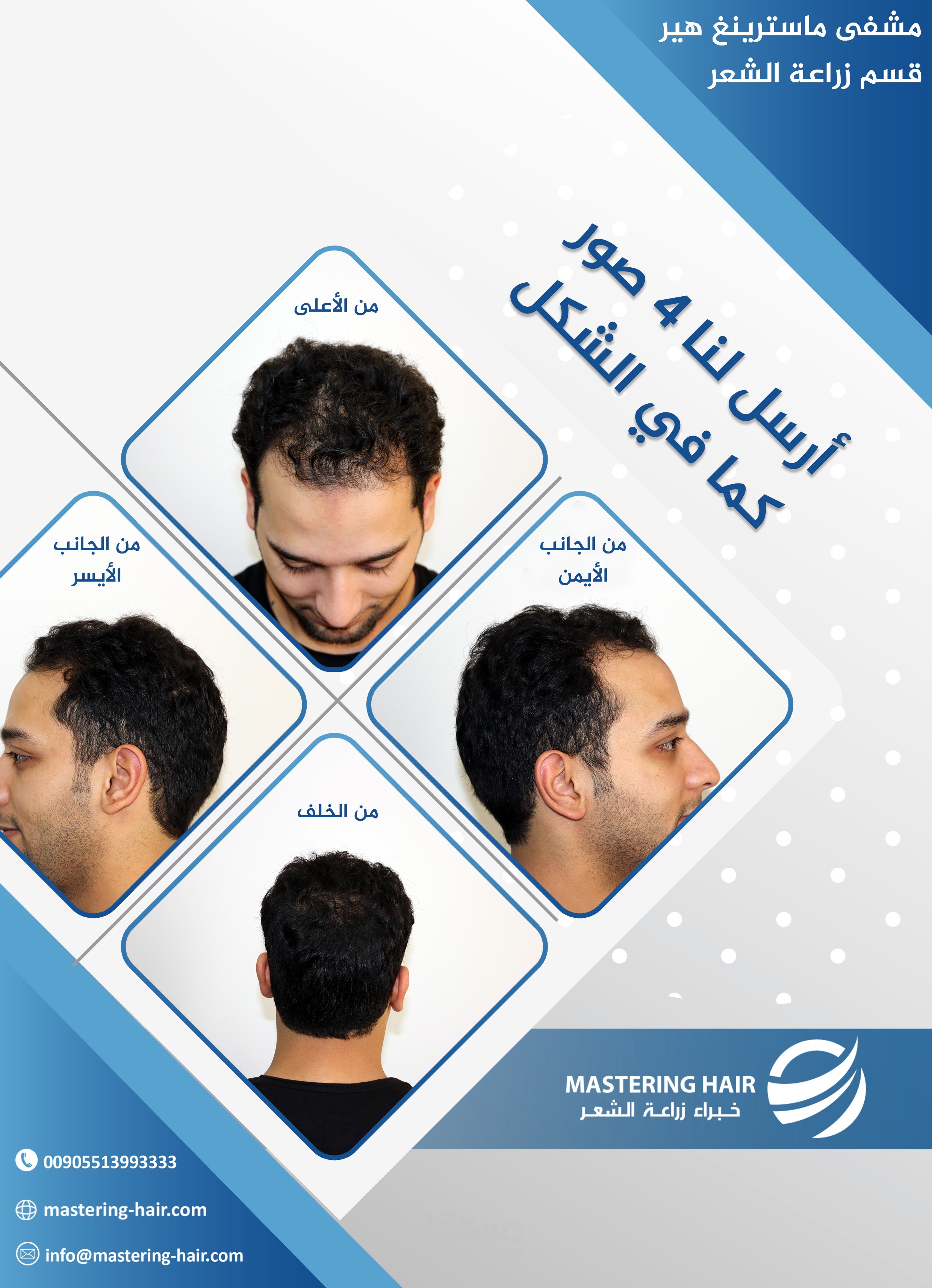 بوستر لمشفى زراعة شعر  Poster