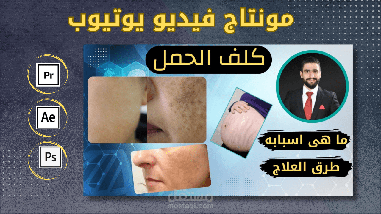 مونتاج فيديو عن مرض كلف الحمل واسبابه وطرق علاجه - قناة الدكتور/ علي المستريحي