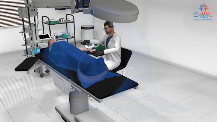 3دي فيديو | تصميم موديلينج وعمل انيميشن ل غرفة عمليات، طبيب،مريضة، أجهزة وأدوات جراحية وطبية (عملية ازالة دوالي وبقع الجلد)