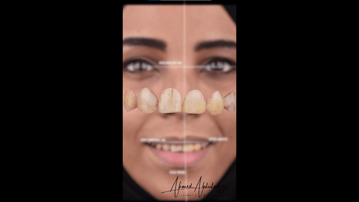 عمل اعلانات لاطباء اسنان