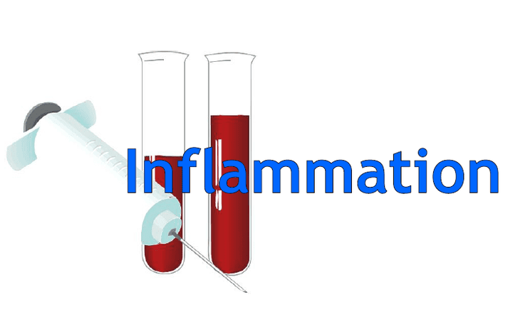 عرض تقديمي بعنوان Inflammation assignment +ppt