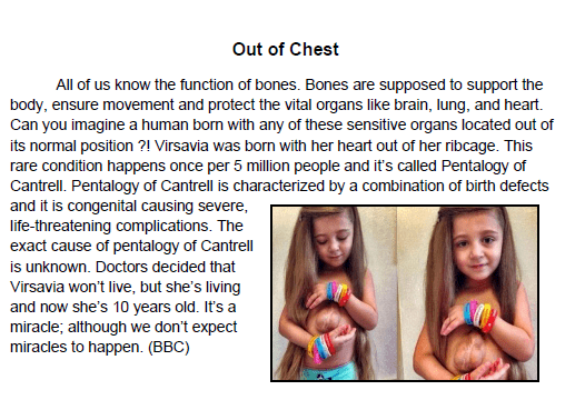 Out Of Chest article مقالة لمجلة طبية