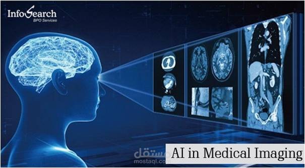 تجزيئ الصور الطبية باستخدام تقنية الـ Level Set Segmentation