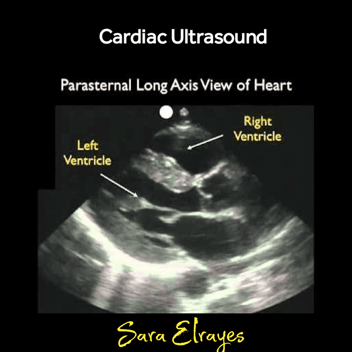 كتابة بحث طبي عن Cardiac Ultrasound