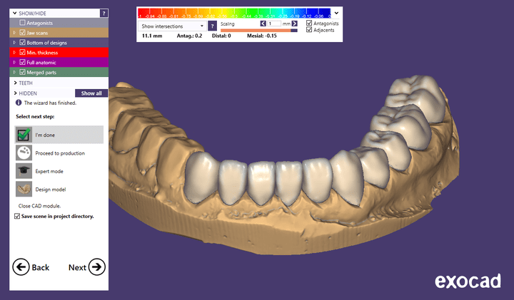 Multiple lower arch crowns