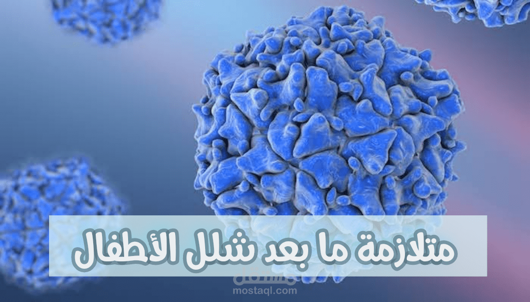 كتابة مقال عن متلازمة ما بعد شلل الأطفال