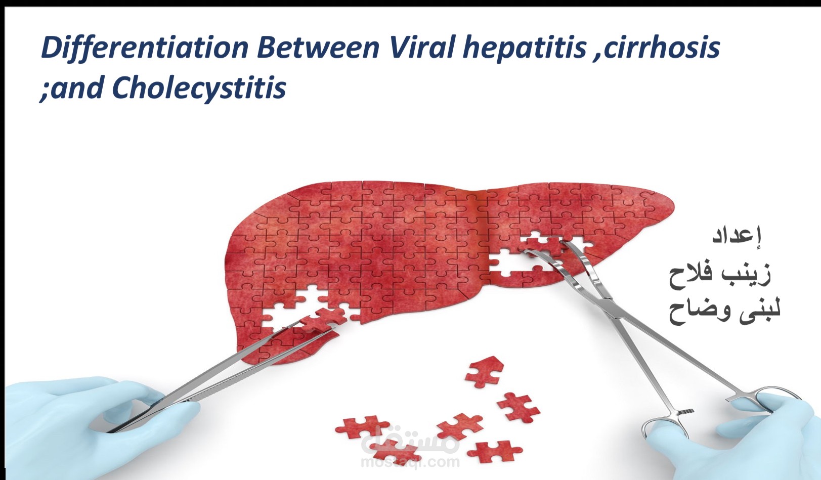 Differentiation Between Viral hepatitis ,cirrhosis ;and Cholecystitis