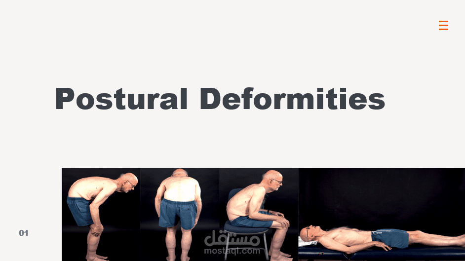 عرض تقديمي عن Postural Deformities